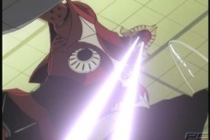 Eye Lasers